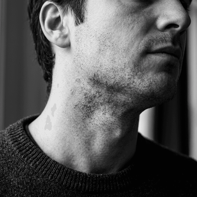 Choosing A Moisturizer For Sensitive Men's Skin